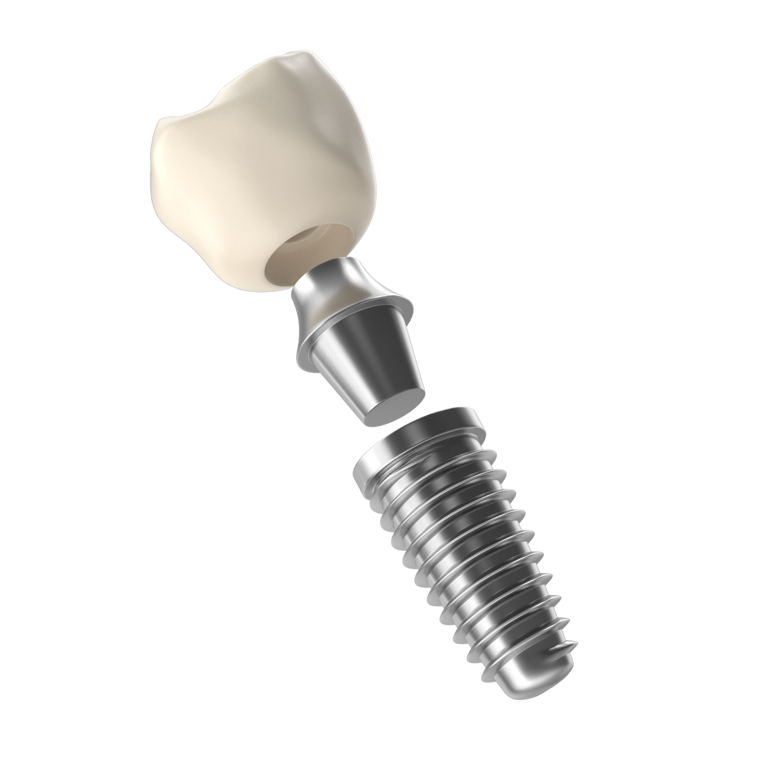 3D-Modell eines Zahnimplantats mit Krone, Abutment und Schraube